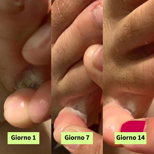 Skina® Piedi Sani