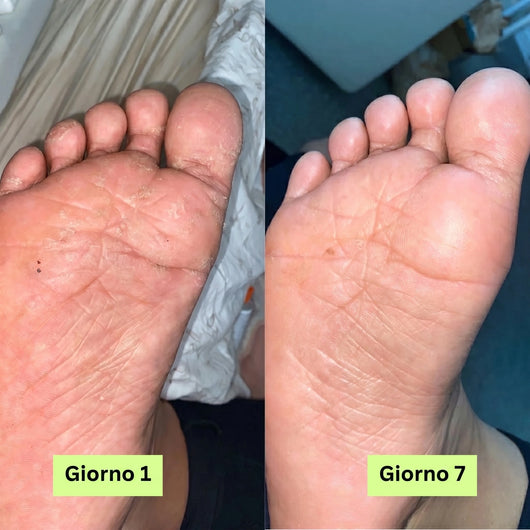 Skina® Piedi Sani