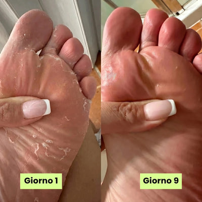 Skina® Piedi Sani