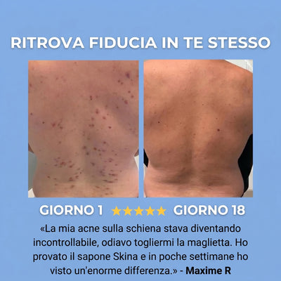 Skina® Schiena Netta