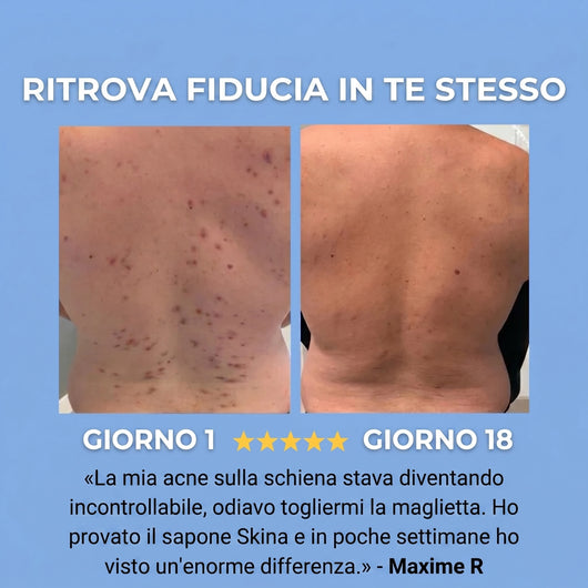 Skina® Schiena Netta