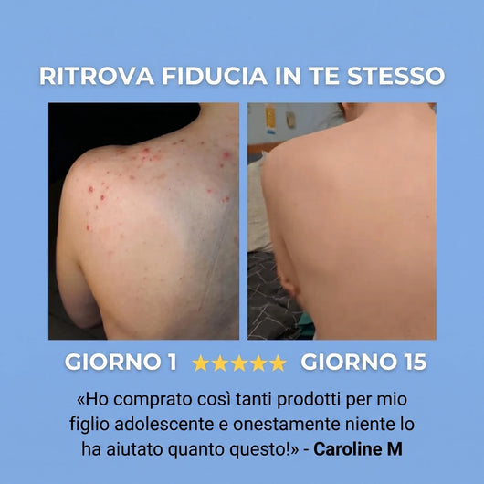 Skina® Schiena Netta